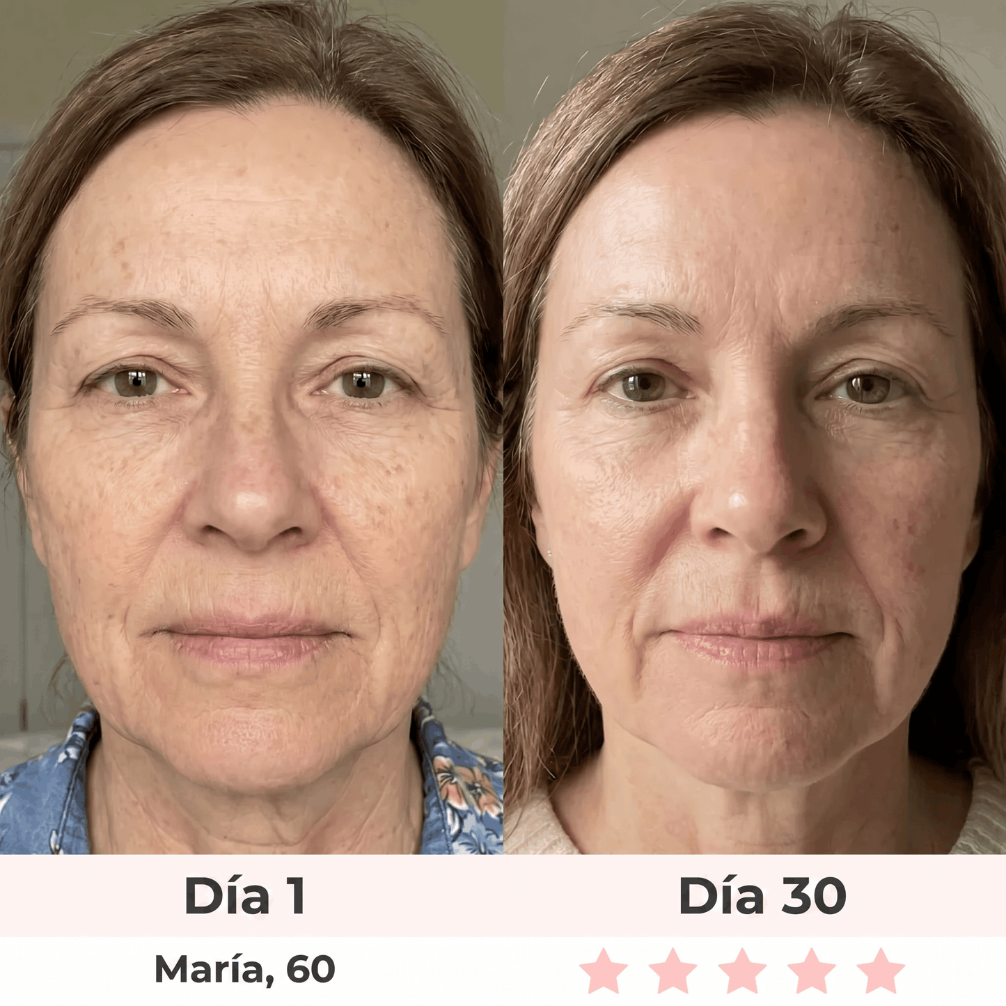 Lumea Sérum anti-edad con vitamina C
