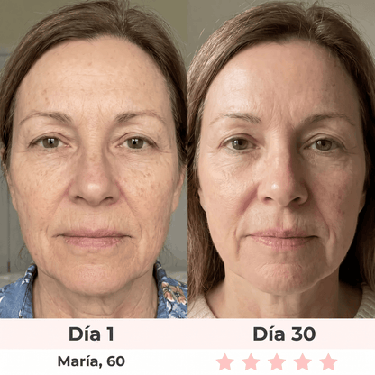 Lumea Sérum anti-edad con vitamina C